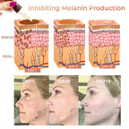 【Dermatologist-Recommended】 VC Spot-Correction & Whitening Cream Set