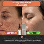 【Dermatologist-Recommended】 VC Spot-Correction & Whitening Cream Set